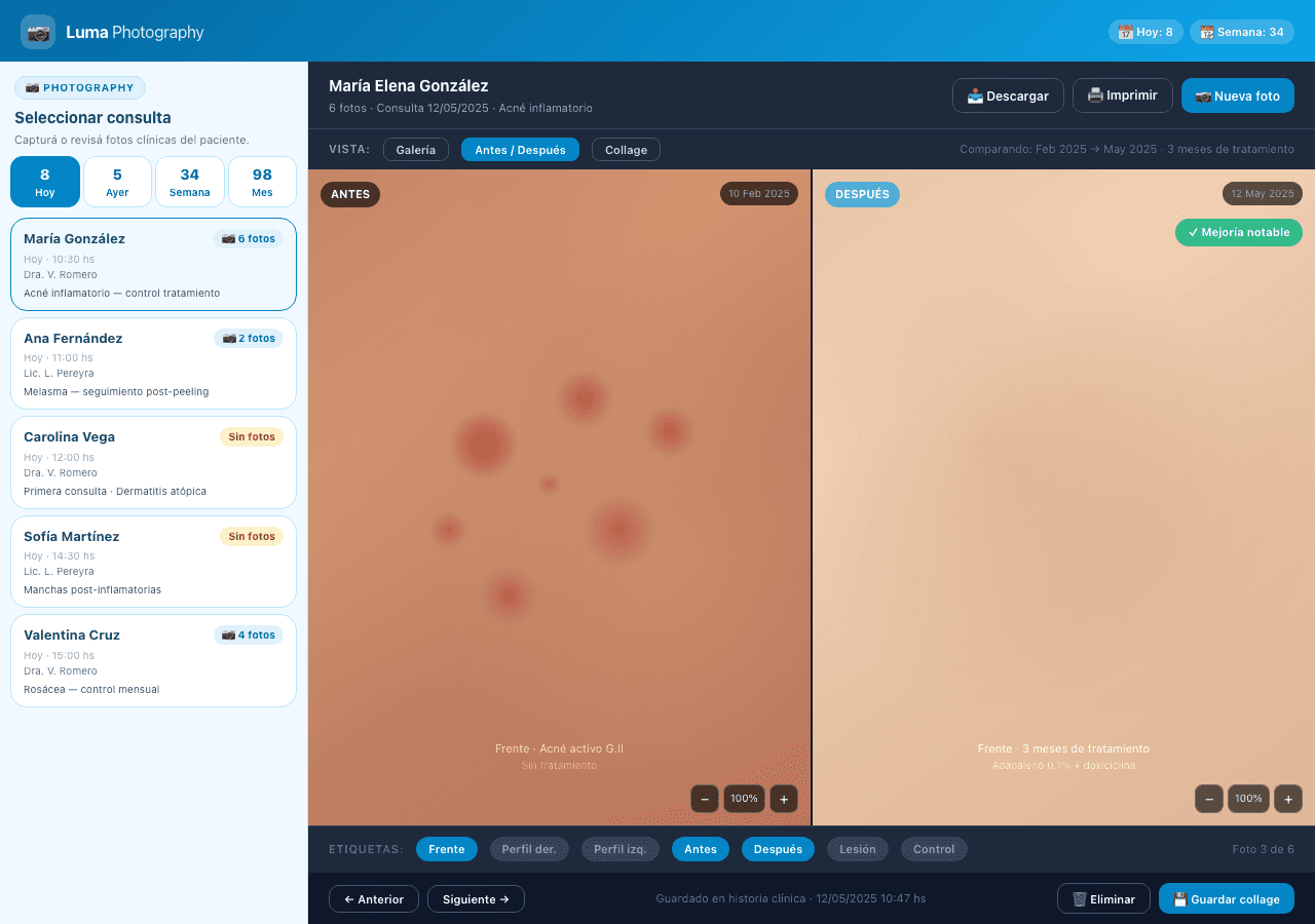 App Photography de Luma Software — comparación antes/después